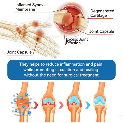 Tiwrold® BPC-157 Joint Healing Cream🦴Treats Arthritis, Neuropathy, Rheumatism, Sports Injuries & More🏆