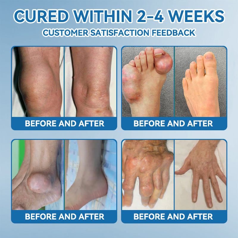 Tiwrold® BPC-157 Joint Healing Cream🦴Treats Arthritis, Neuropathy, Rheumatism, Sports Injuries & More🏆