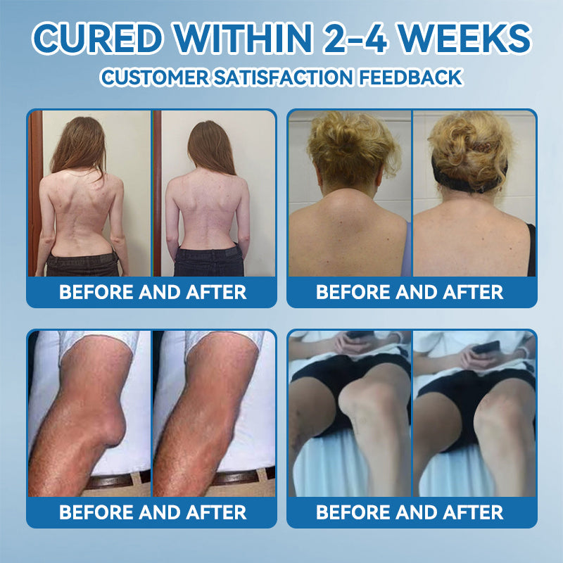 Tiwrold® BPC-157 Joint Healing Cream🦴Treats Arthritis, Neuropathy, Rheumatism, Sports Injuries & More🏆