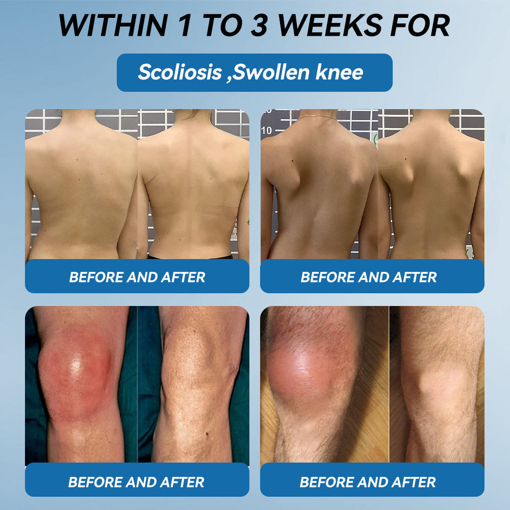 Tiwrold® BPC-157 Joint Healing Cream🦴Treats Arthritis, Neuropathy, Rheumatism, Sports Injuries & More🏆