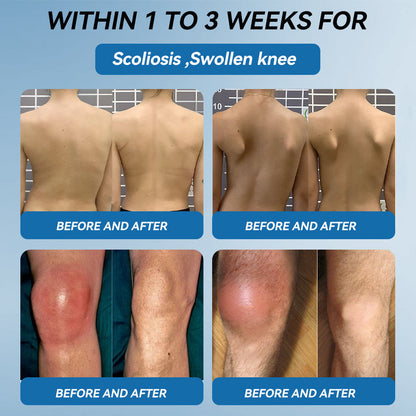 Tiwrold® BPC-157 Joint Healing Cream🦴Treats Arthritis, Neuropathy, Rheumatism, Sports Injuries & More🏆