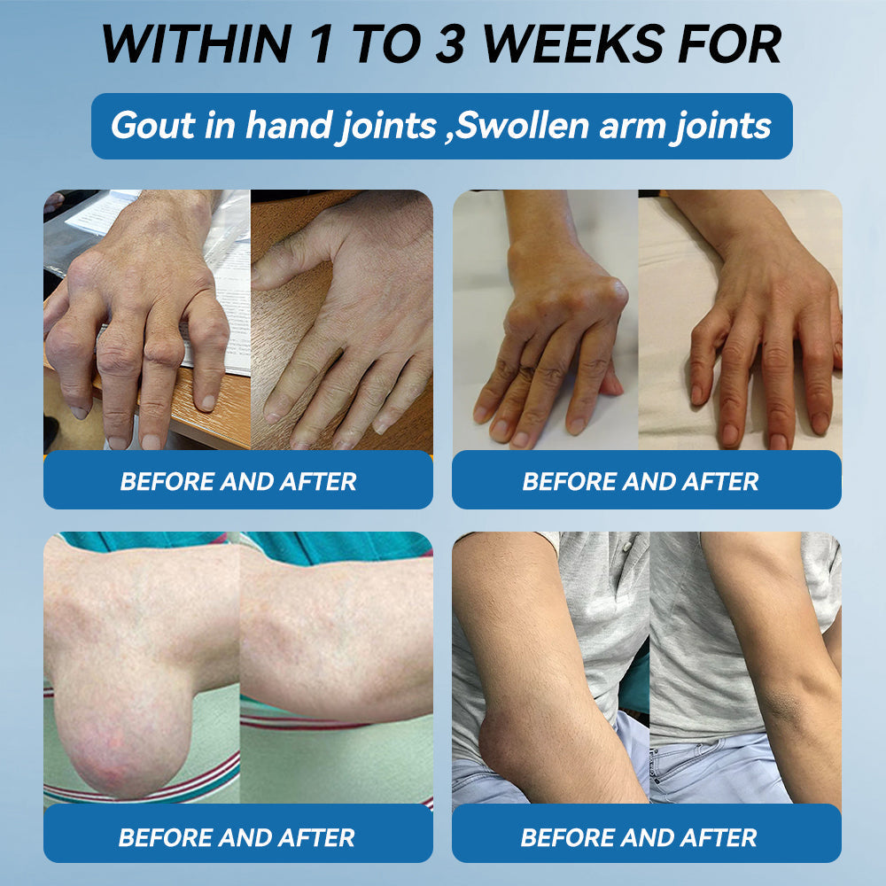 Tiwrold® BPC-157 Joint Healing Cream🦴Treats Arthritis, Neuropathy, Rheumatism, Sports Injuries & More🏆