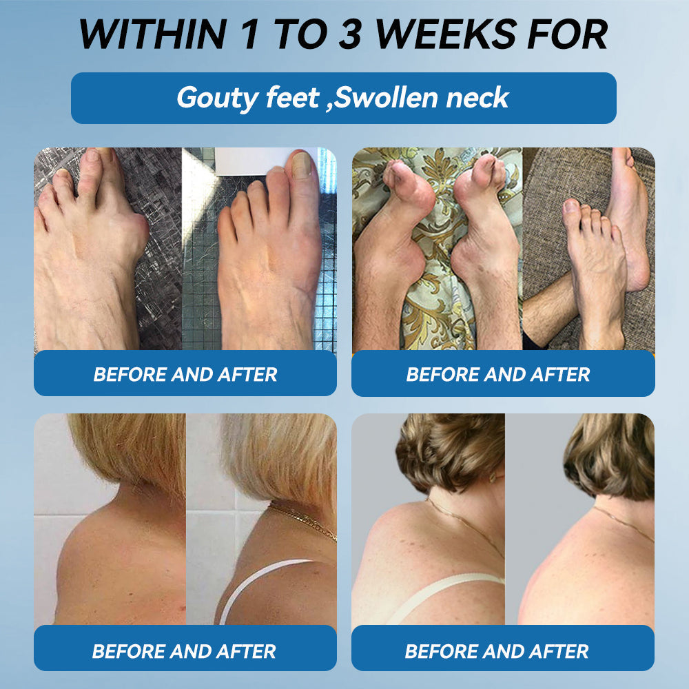 Tiwrold® BPC-157 Joint Healing Cream🦴Treats Arthritis, Neuropathy, Rheumatism, Sports Injuries & More🏆